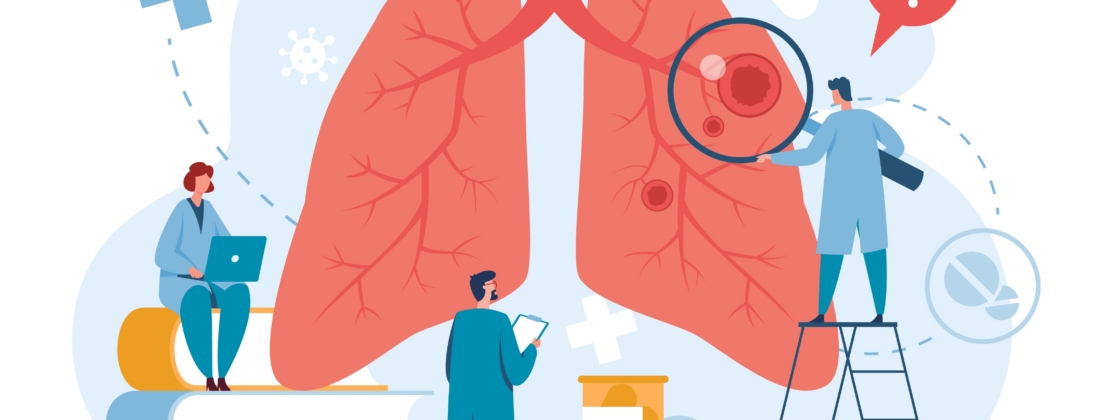 Lungs healthcare, vector concept