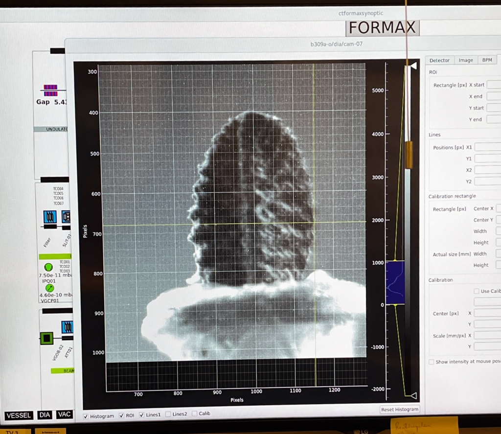 Prescan of the goldenrod seed